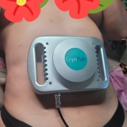 Cool Sculpting with CryoPad at Beba Beauty & Spa in FLOWERY BRANCH, GA