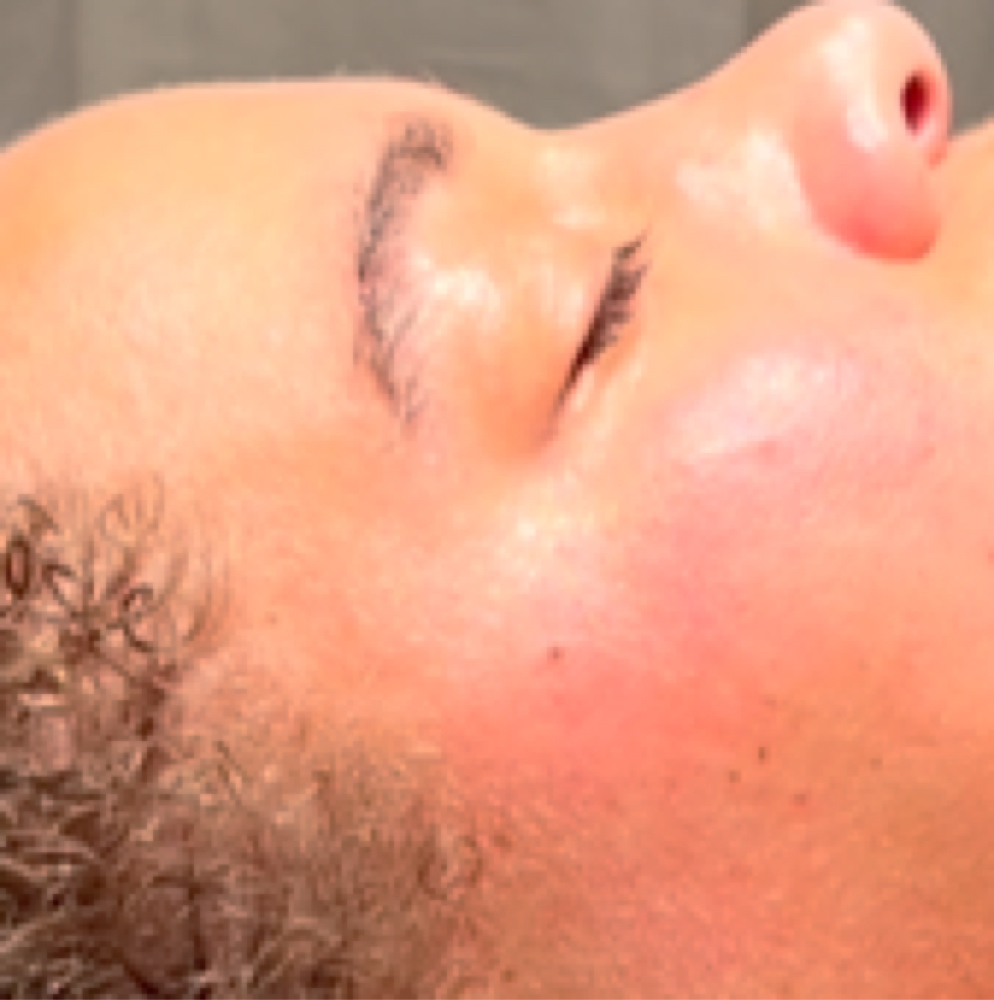 Eye Therapy *add On at Bridget  Wilson Skin in Downey, CA