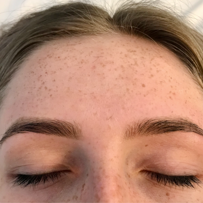 Brow Refresh at Fitzskin in Gilbert, AZ