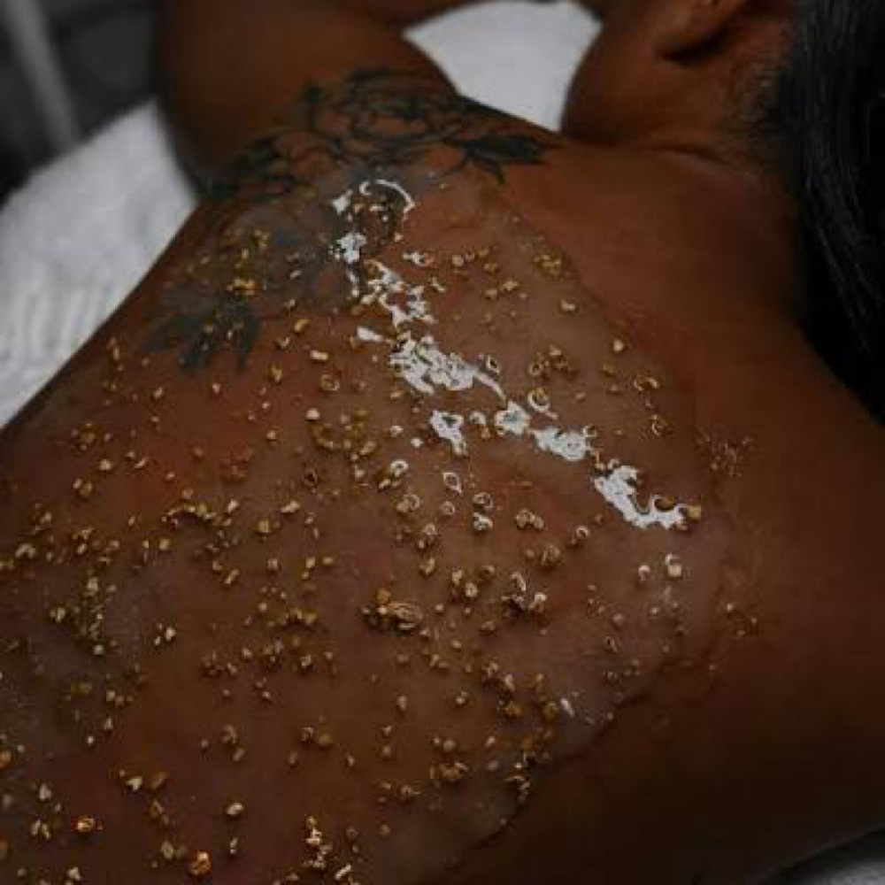 Back Renewal Treatment at EHT Spa in Valdosta, GA