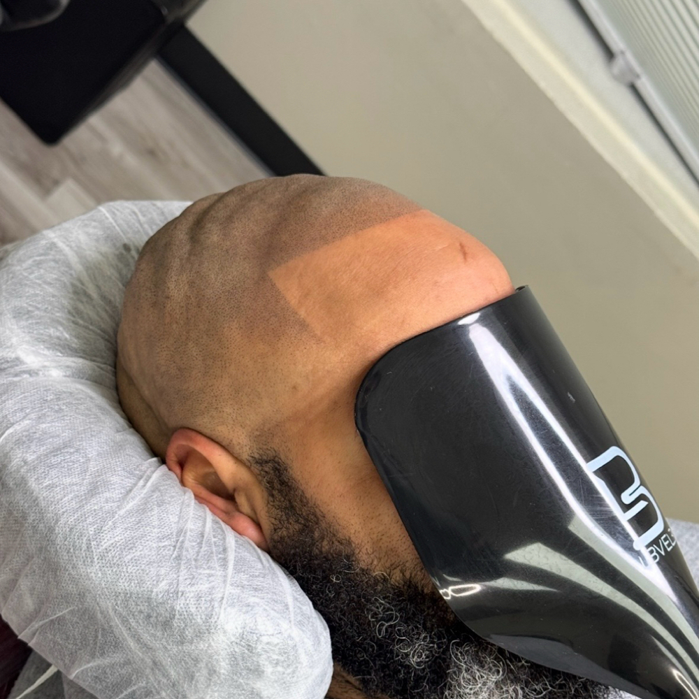 SMP (Scalp-Micro Pigmentation) at Deuce Fadez Grooming LLC in Hapeville, GA