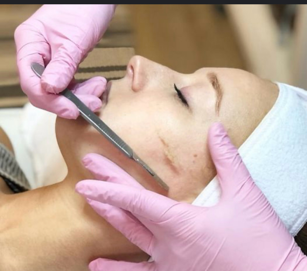 Add On Dermaplaning To Any Peel