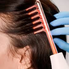 High Frequency Scalp Facial