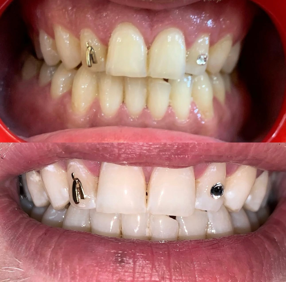 STRAIGHT RAZOR™ [LIMITED EDITION]