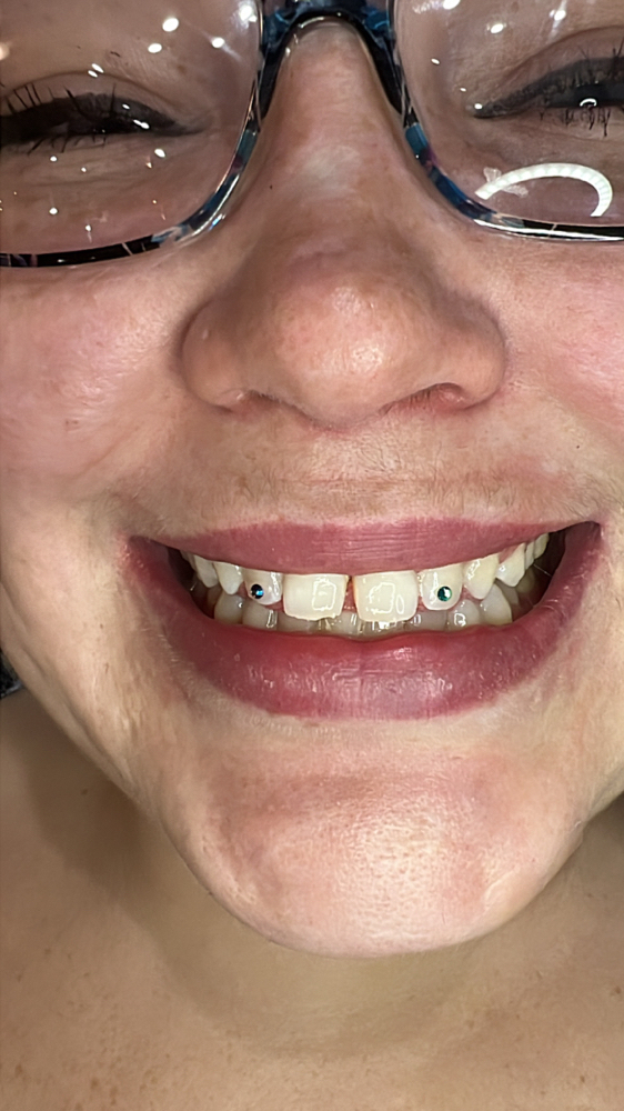 Tooth Gem (Round swarovski Crystal) at Lasting Impressions LHC in Lake Havasu City, AZ