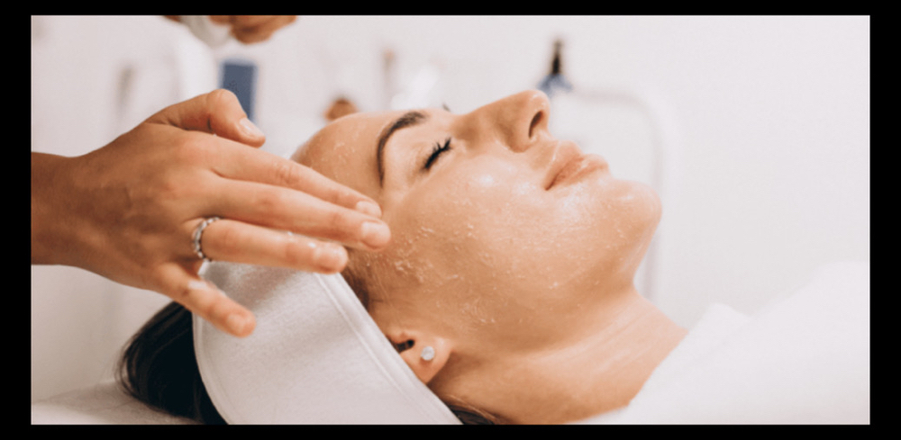 Acne Lift Peel (Add-On)