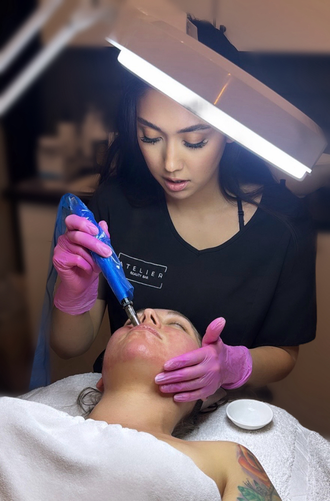 MicroNeedling and LED Light