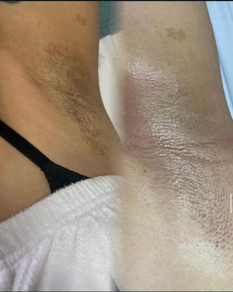 Armpit Wax at ASACREDV in Rocky Mount, NC