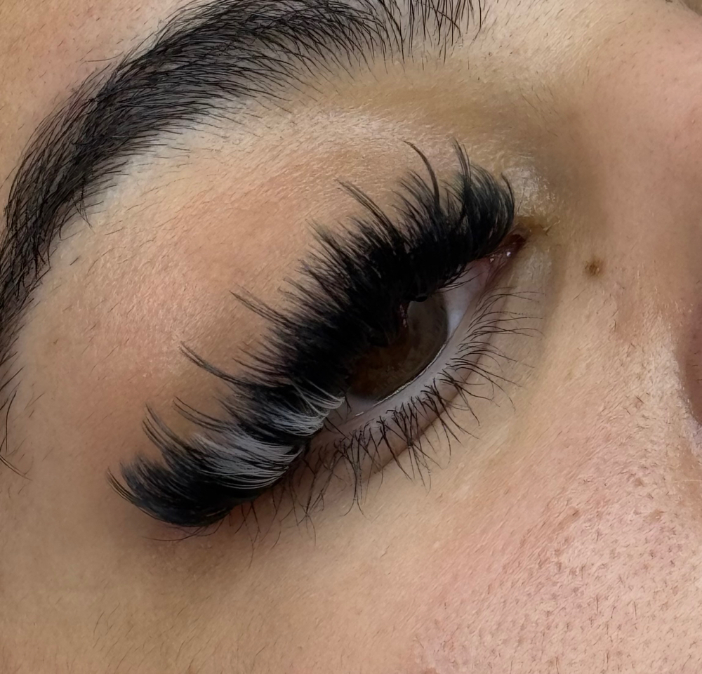 Mega Volume Fill