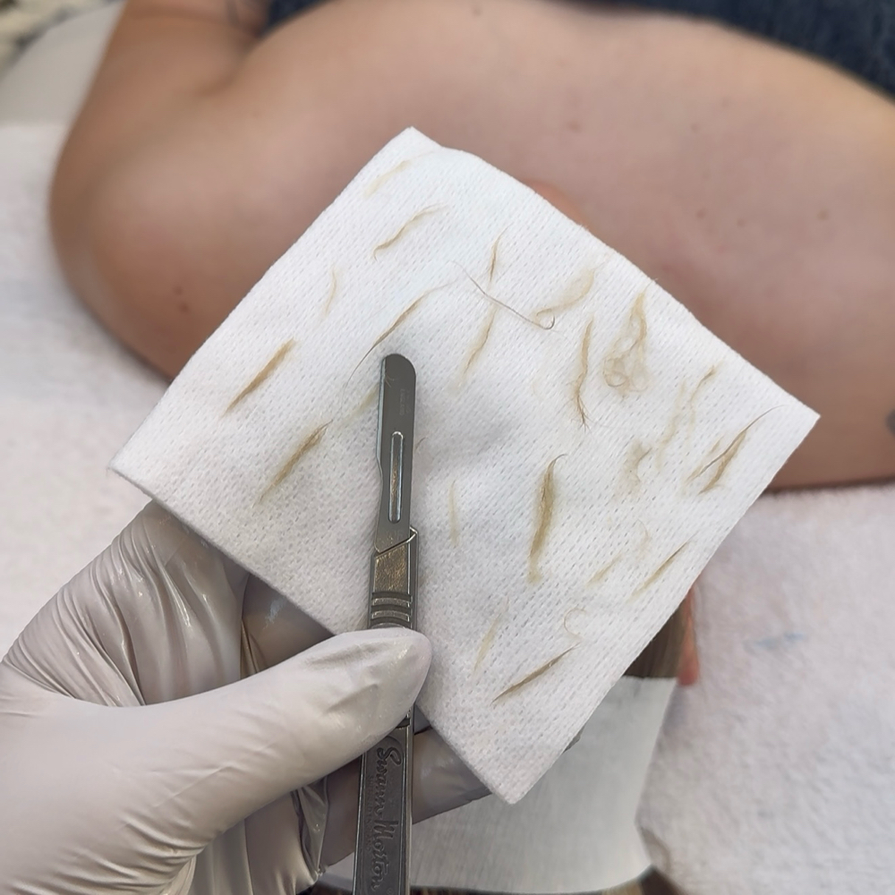Express Dermaplaning Facial