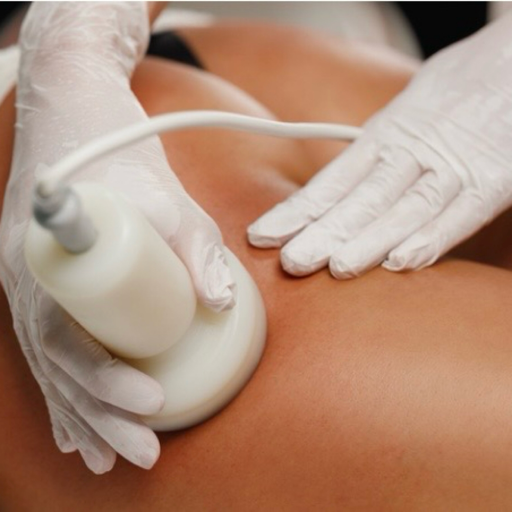 Cellulite Sculpting, Butt/ Thighs at Sparkle Smile Spa LLC in Chandler, AZ