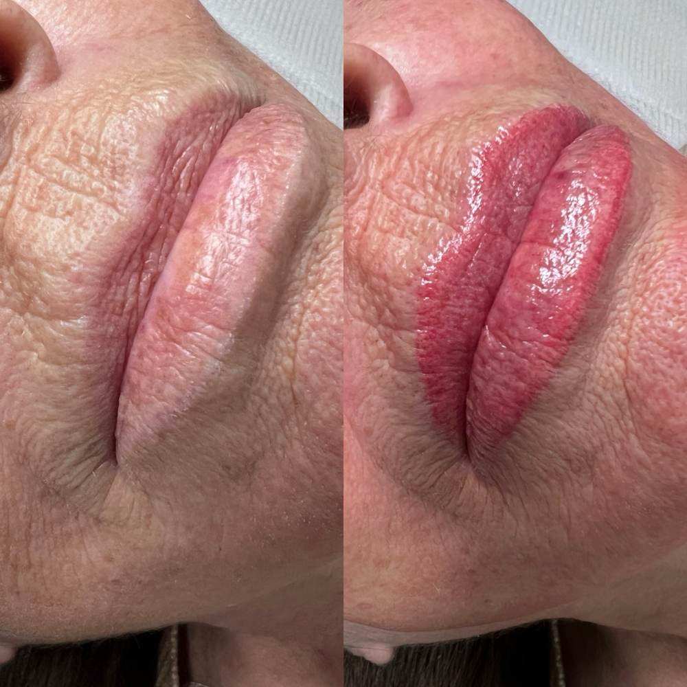 Lip Blushing