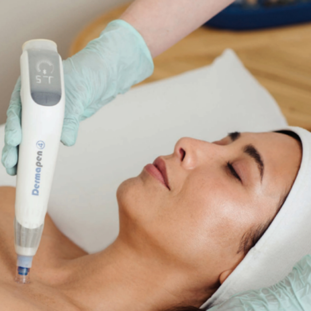 Microneeding at Hanna Horne Esthetics in Goldsboro, NC