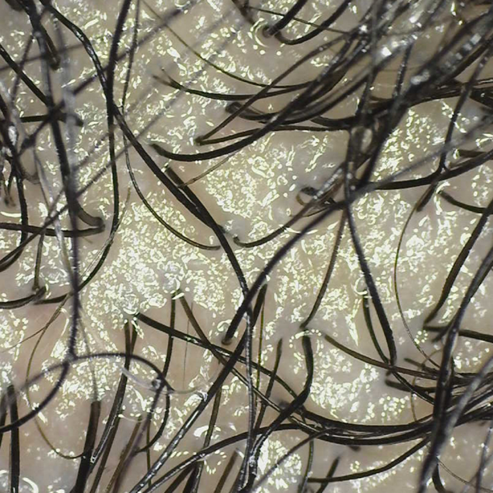 Scalp Consultation at FRO Head Spa in Plano, TX
