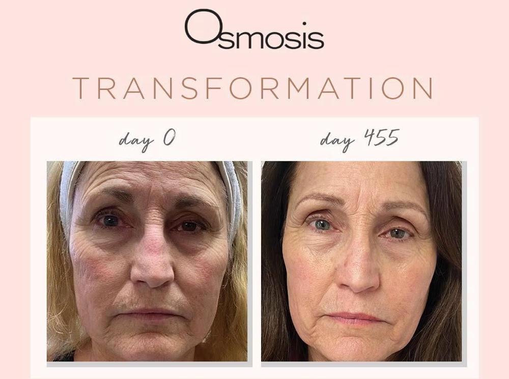 Osmosis Beauty Age Reversal Facial