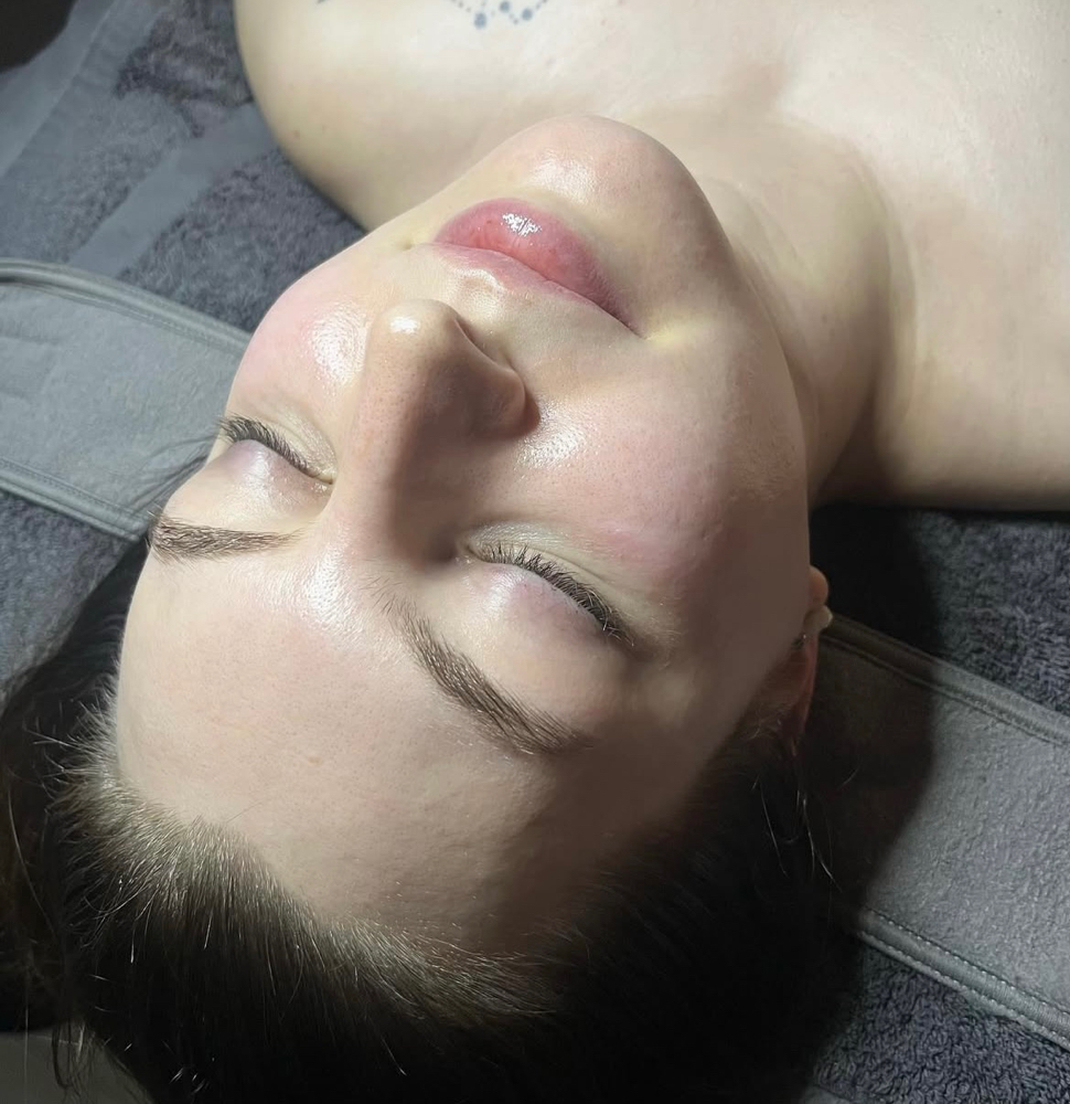 Renewed Facial