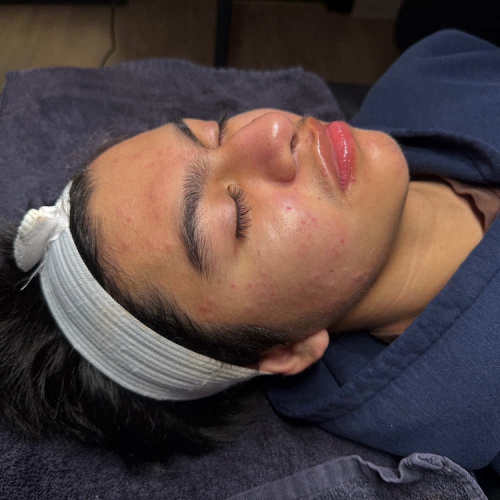 Teen Glow at SKN by Napualani in Fountain Valley, CA