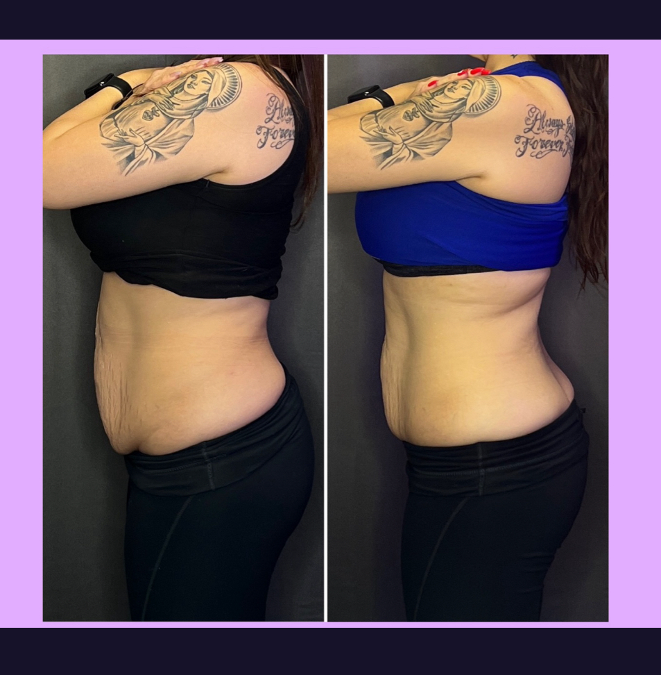 1 1/2hr Body Sculpting Session