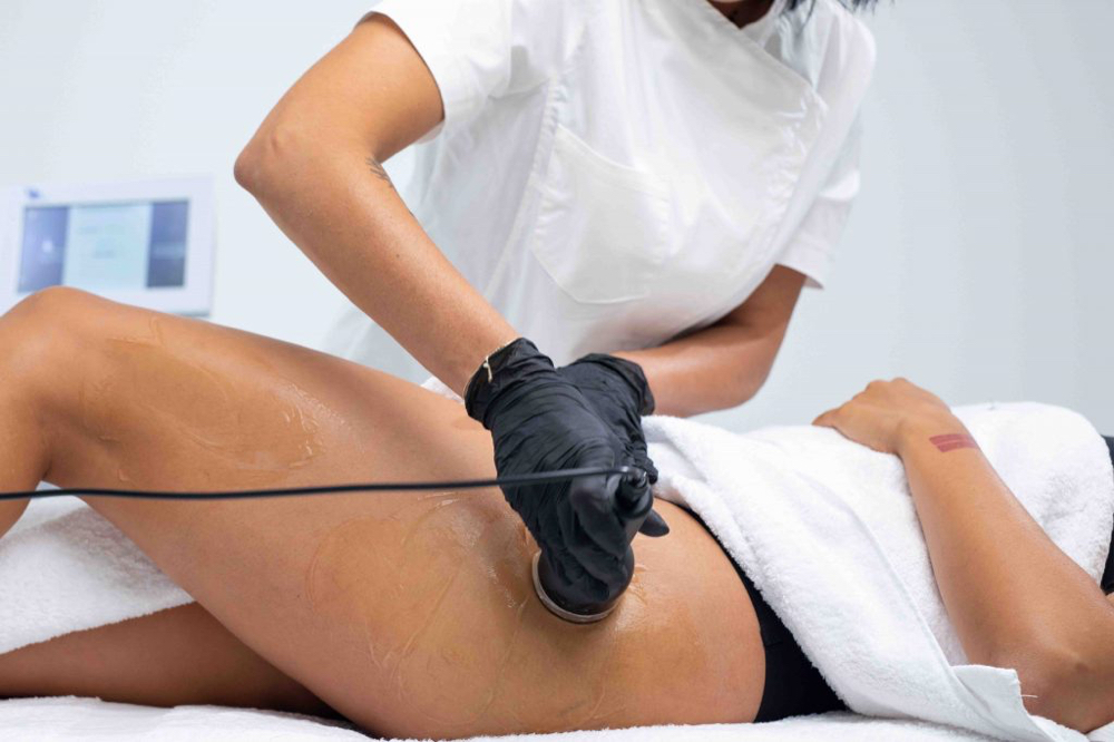 Lipo Cavination -Outer Thighs