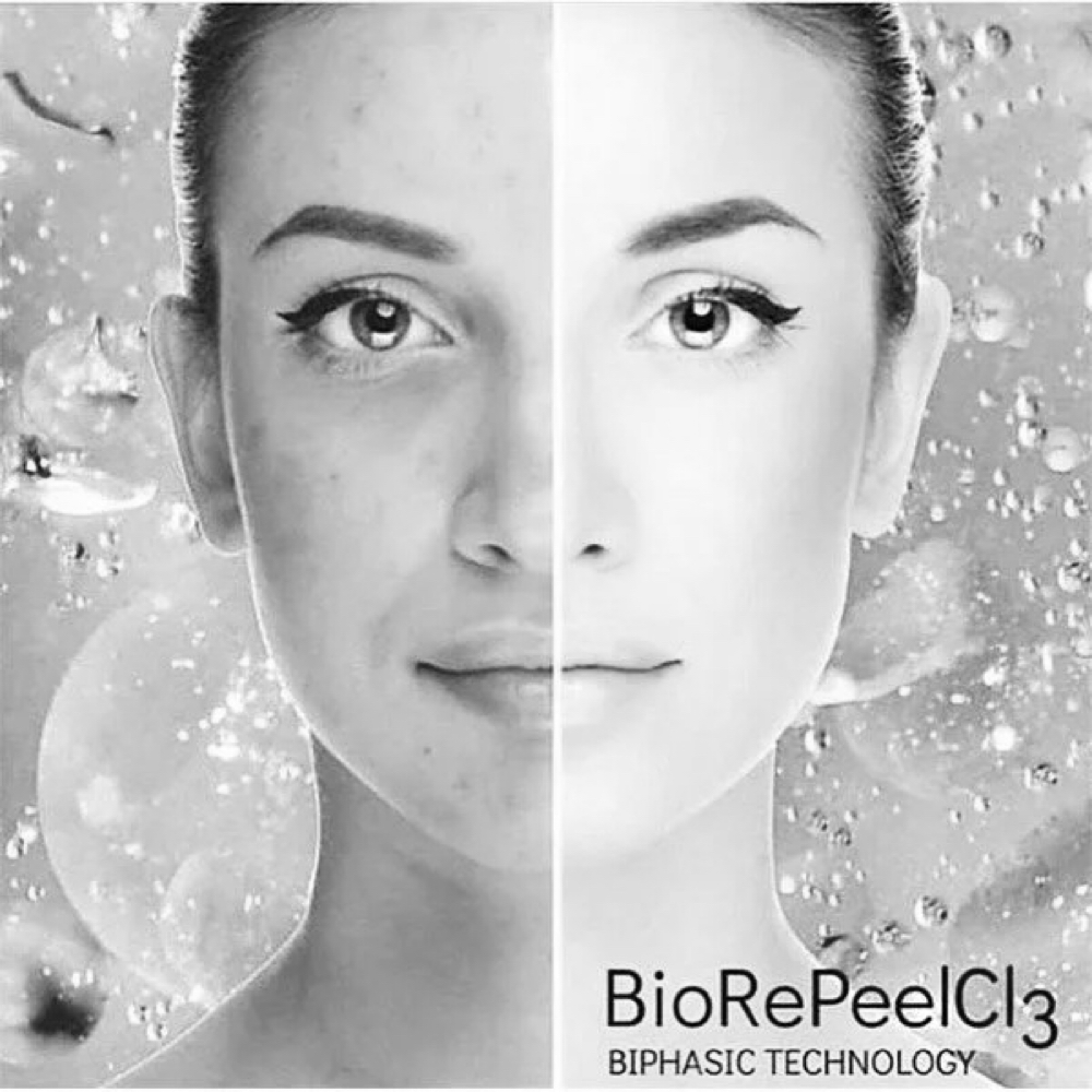 BioRePeelCl3 at Rose And Thorn Day Spa in Wheat Ridge, CO