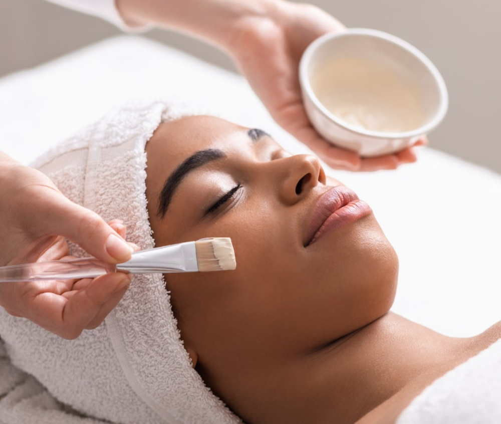 Chemical Peel