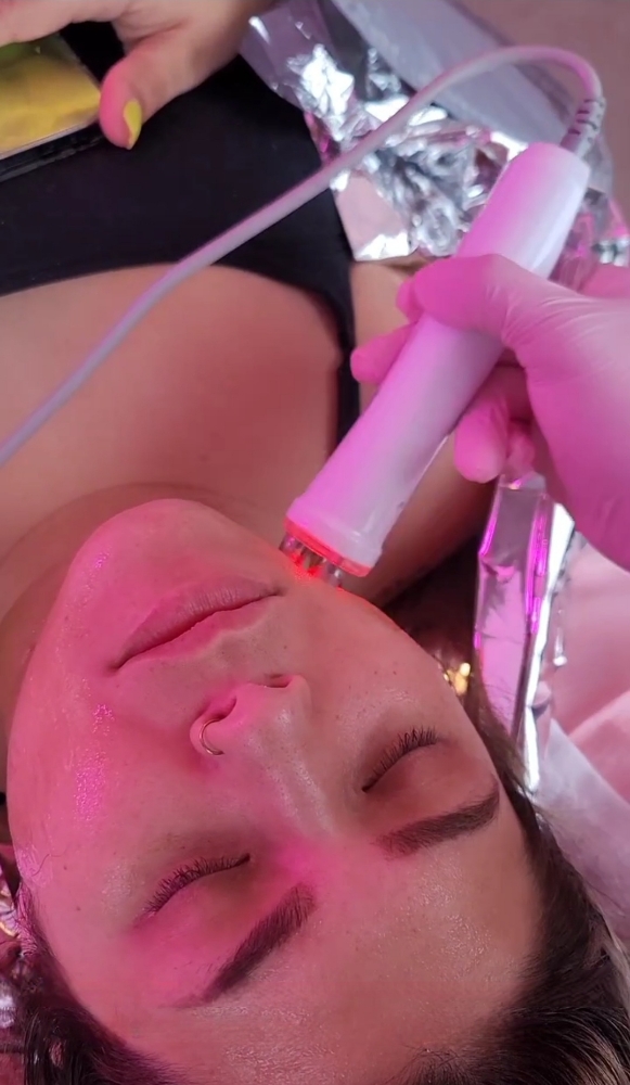 Lymphatic Facial With (Rf) at Beauty2you in Visalia, CA