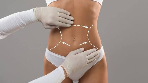 Body Sculpting Consultation