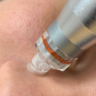 Hydroderm Glow Facial at Serene Skin byWansada in Matthews, NC