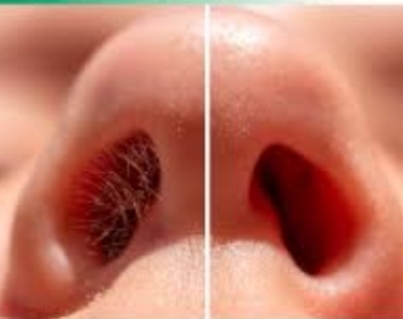 Nose Waxing