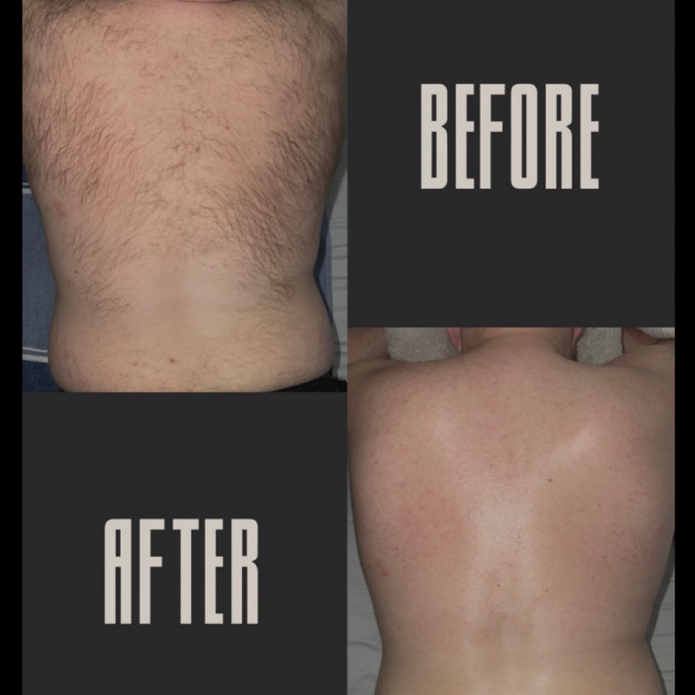 Back Wax at Luxe Skin & Beauty LLC in Stevens Point, WI