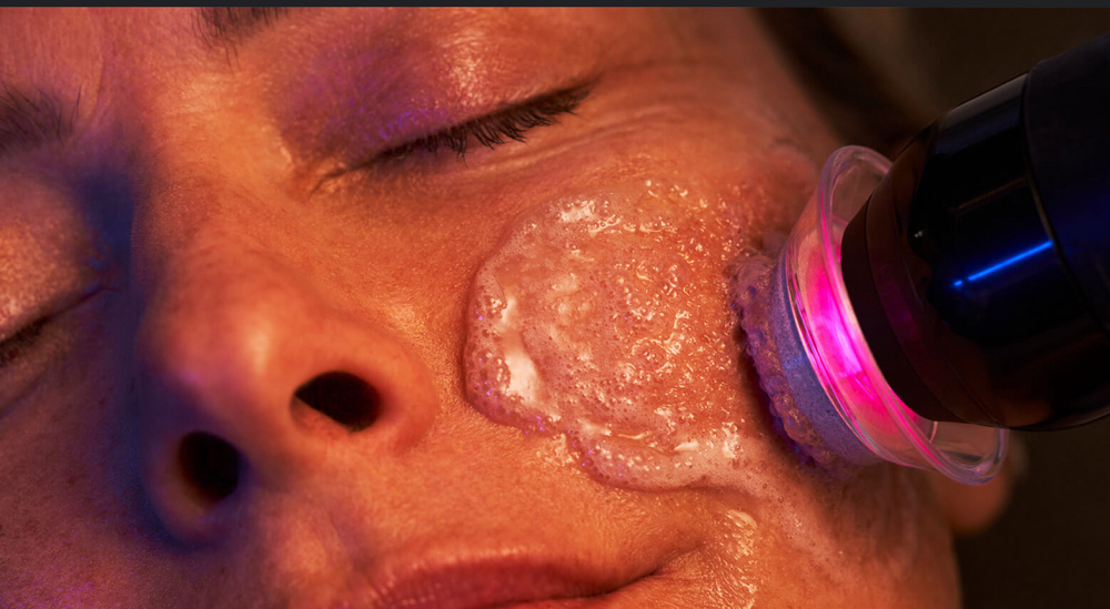 GLO2 FACIAL+ DERMAPLANE & RED LIGHT