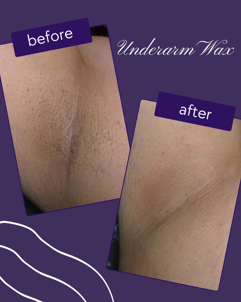 Underarm Wax