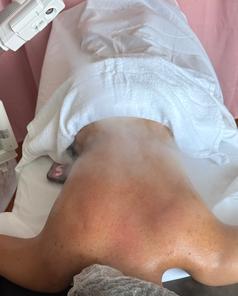 Back Treatment at In His Image Esthetics in Rosedale, NY