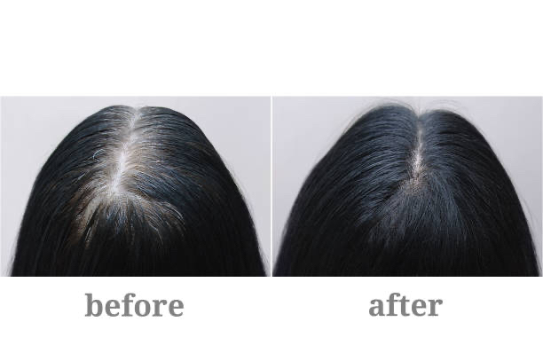 Root Touch Up