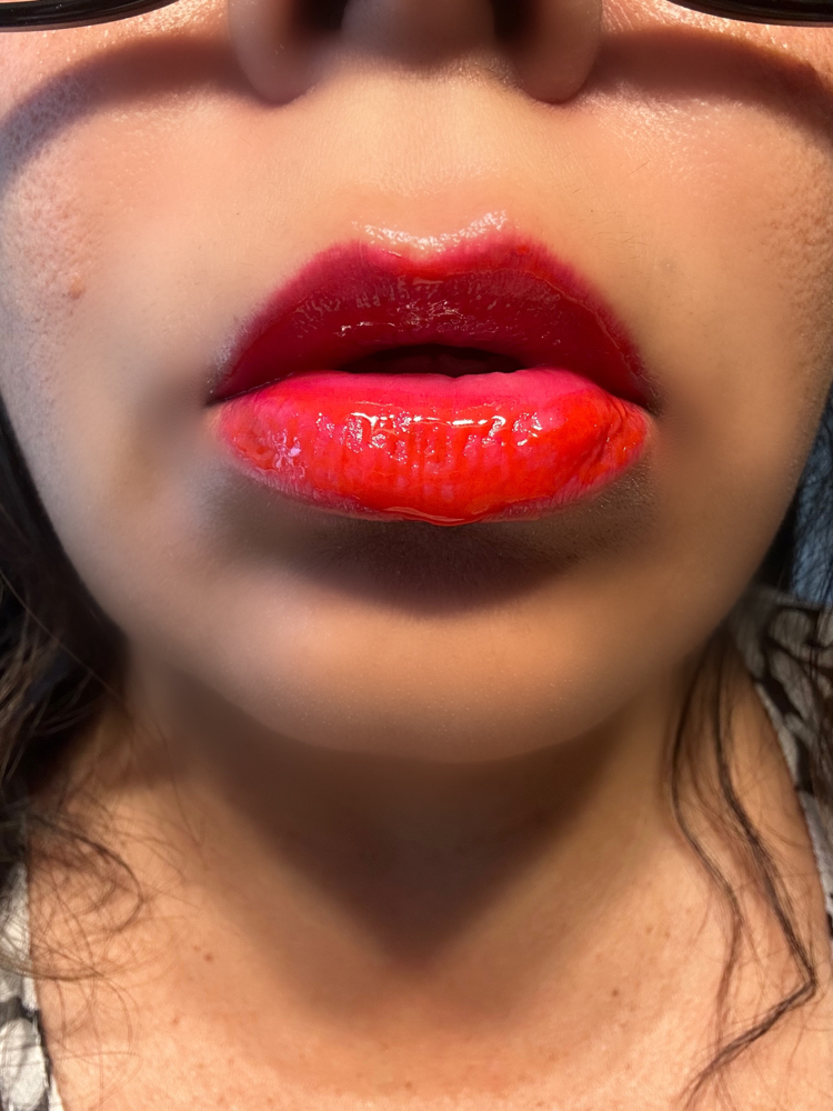 Candy lips - Hydro Treatment