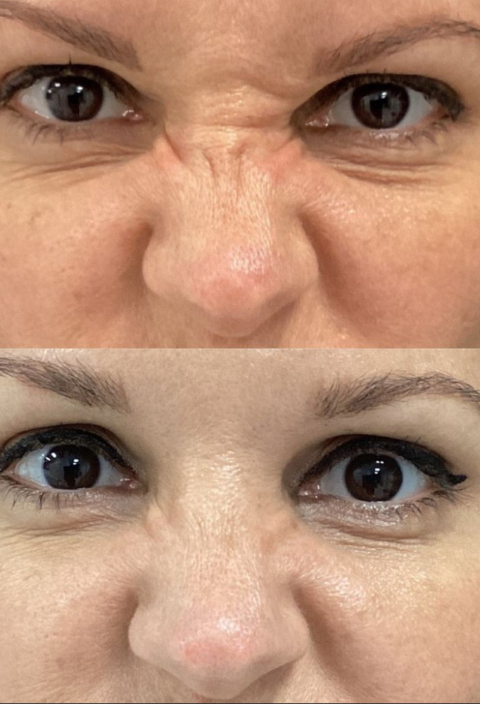 Casper Crinkle Fix (bunny lines)