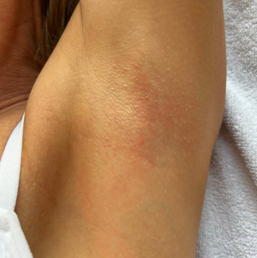 Underarm Wax