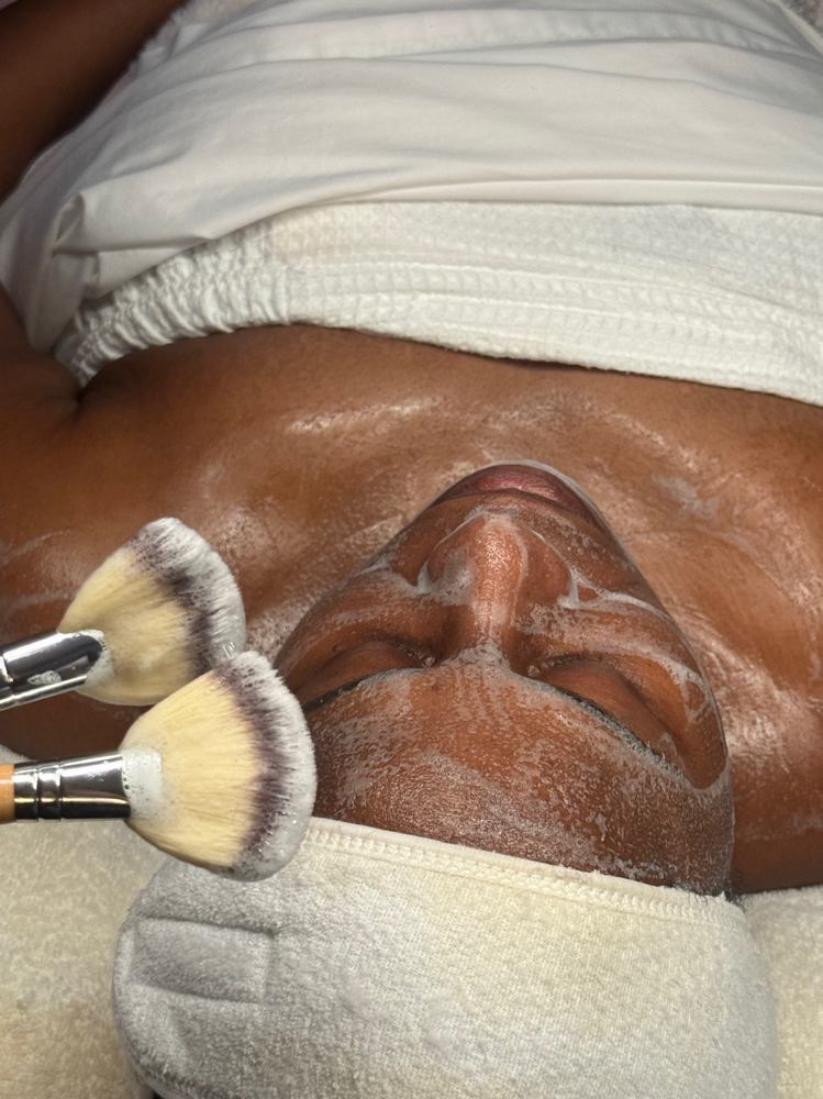 Oxygenating Smores Facial (Acne) at Nikki Lee Esthetics in Pearland, TX