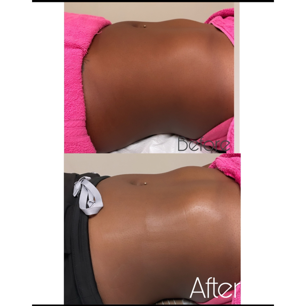 Full Body Lymphatic Massage