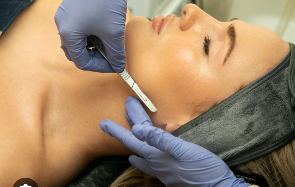 Express Dermaplane