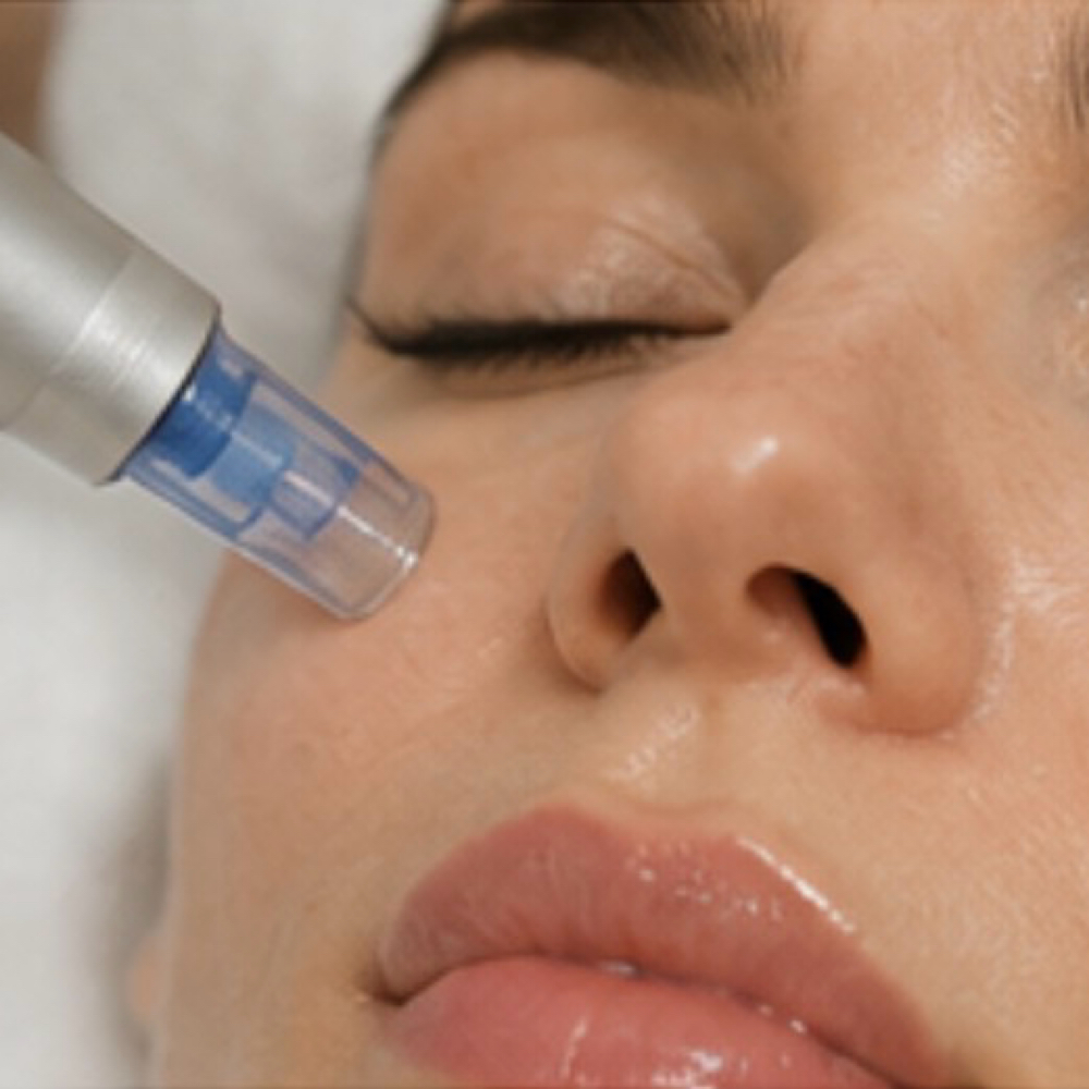 Facial Add-Ons at MS Beauty Studio NY in Staten Island, NY