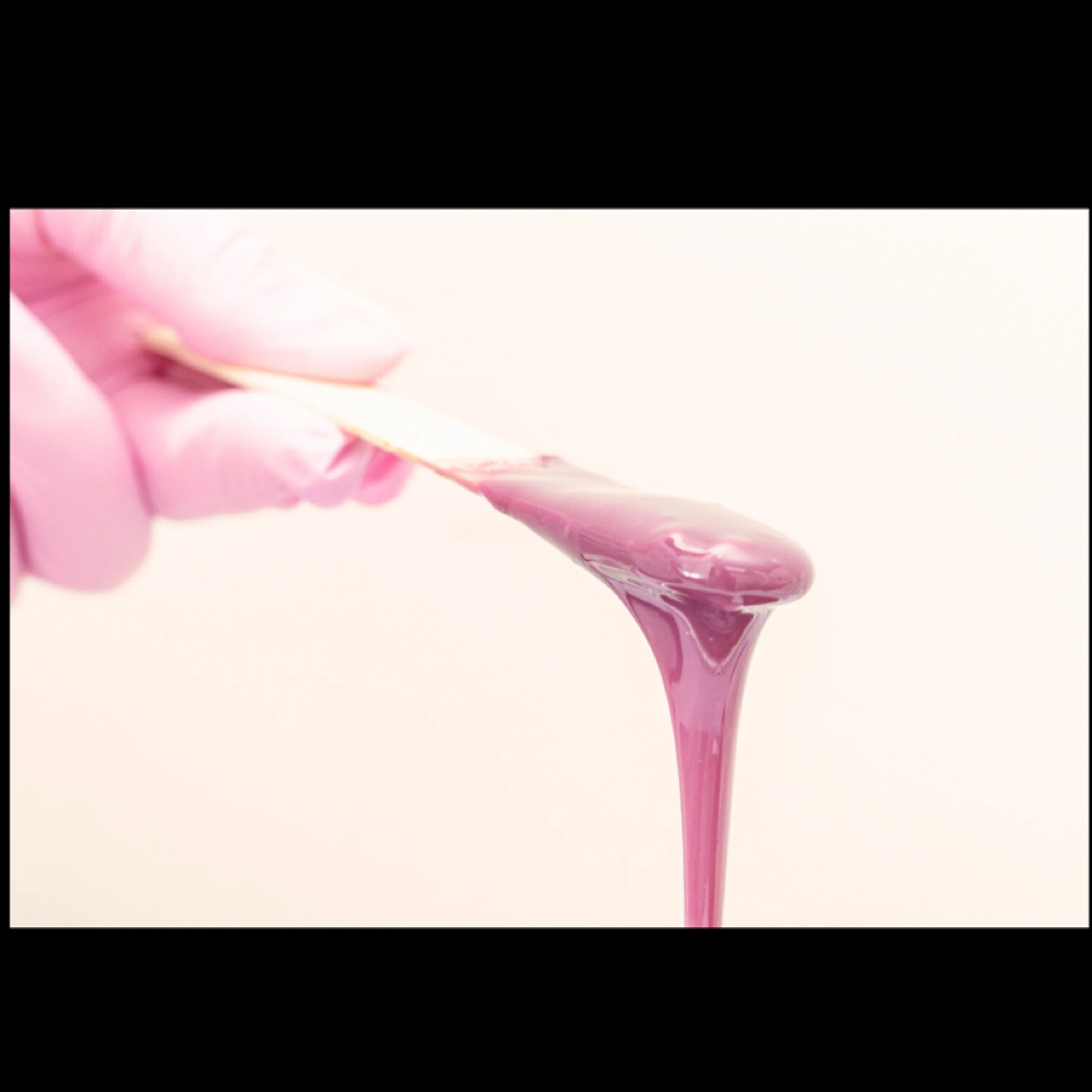 Upper + Lower Lip at Lins Esthetics in Gaithersburg, MD