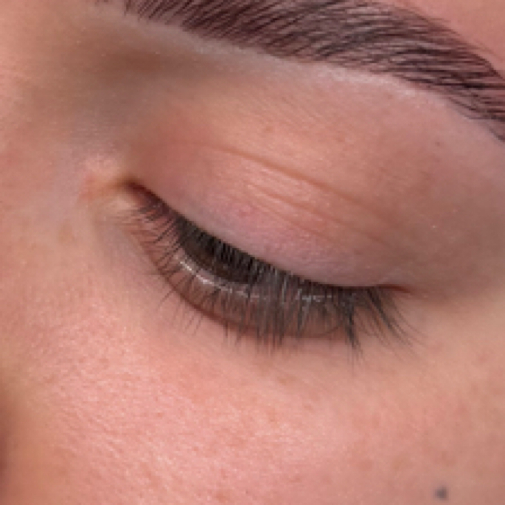 Lash Removal at Kalos Aesthetics in Northglenn, CO