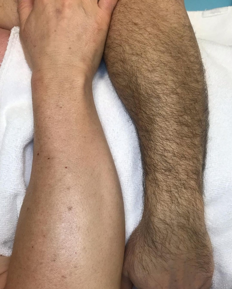 LOWER ARM