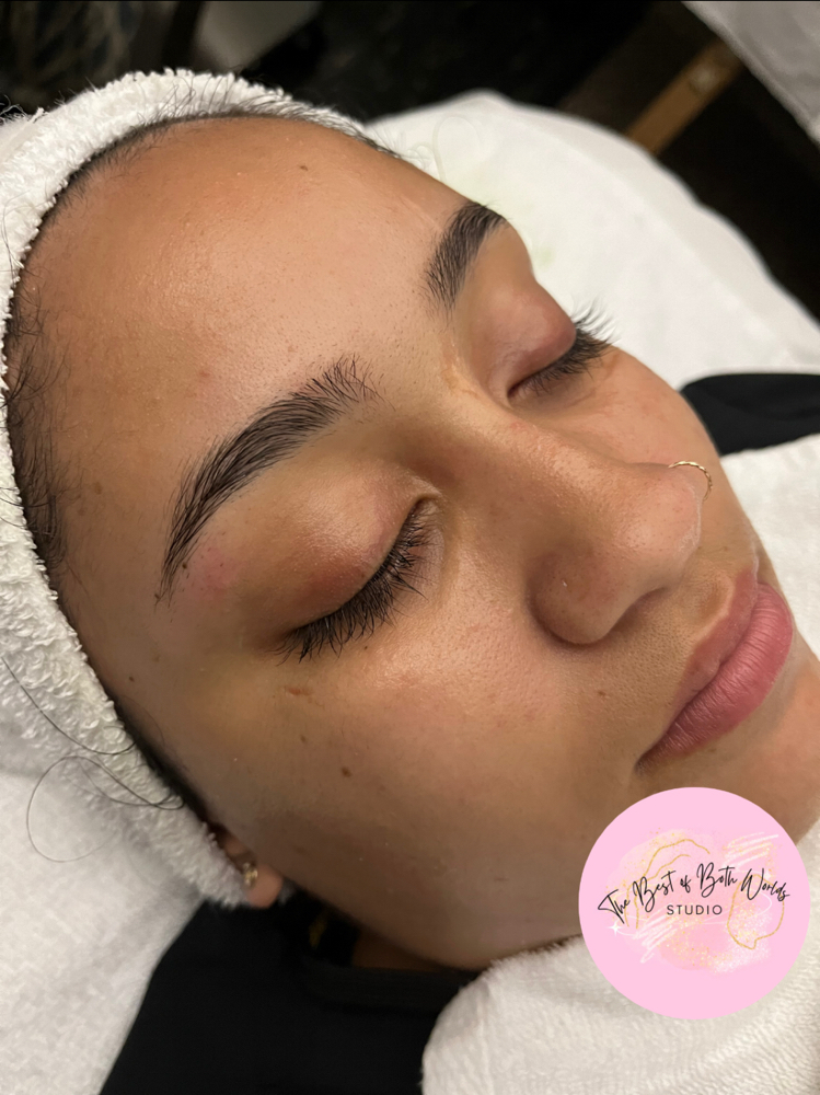 Microdermabrasion Facial