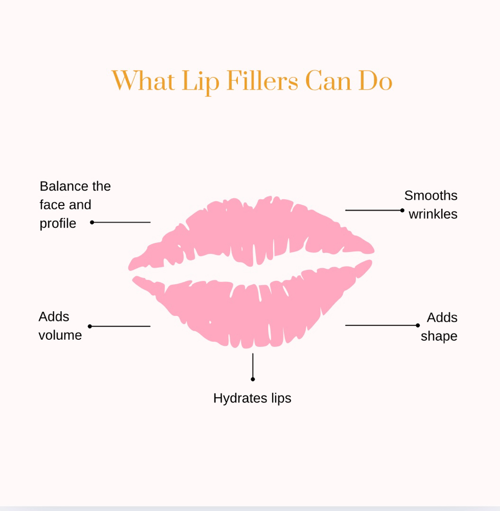 Lip Filler Grand Opening Special
