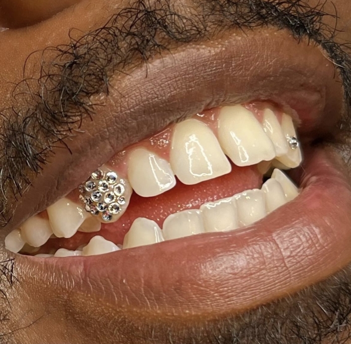 The Icy Tooth Design