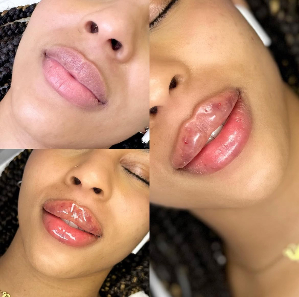 New Client Mini Lip