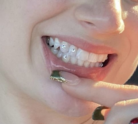 Tooth Gem (4)