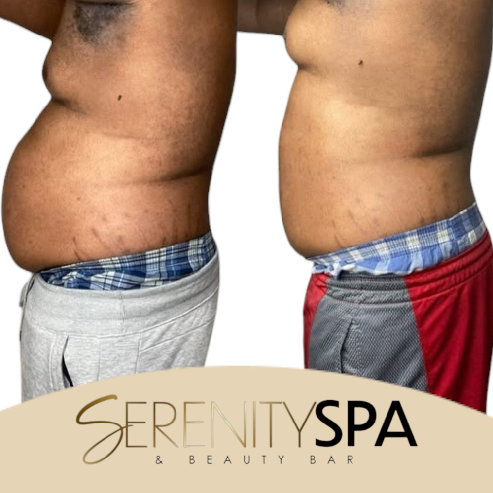 ✨ Snatch Me Up Combo - TOP SELLER at Serenity Spa & Beauty Bar in Warwick, RI